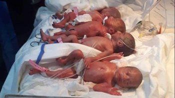 No planeaban tener más hijos, pero por un descuido tuvieron septillizos