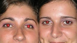 Por qué los ojos salen rojos en las fotos con flash. Por qué los ojos salen rojos en las fotos con flash.