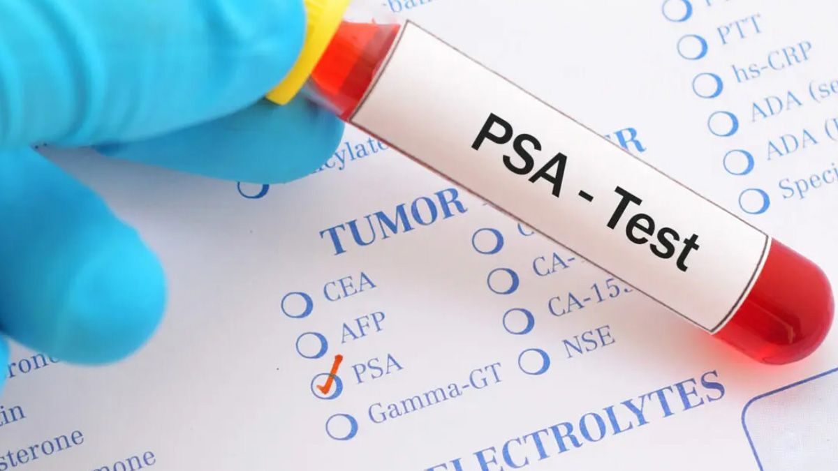 El análisis de PSA, antígeno prostático específico, puede indicar alguna alteración o inflamación de la próstata El análisis de PSA, antígeno prostático específico, puede indicar alguna alteración o inflamación de la próstata