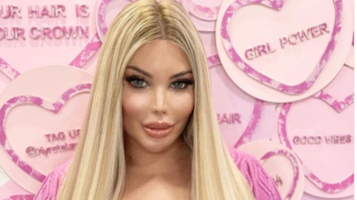 La Barbie humana se hizo una inversión peneana y completó su transformación.&nbsp;