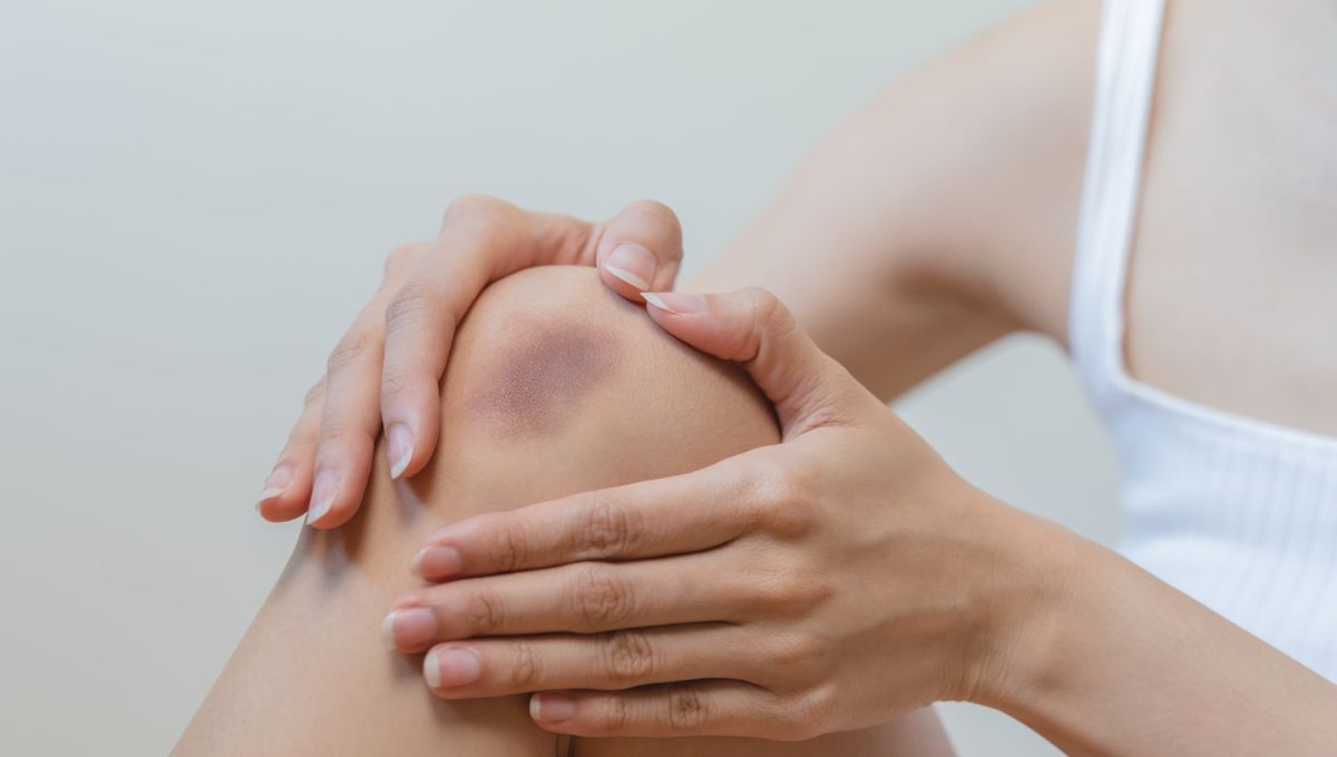 Por qué la RAE acepta 