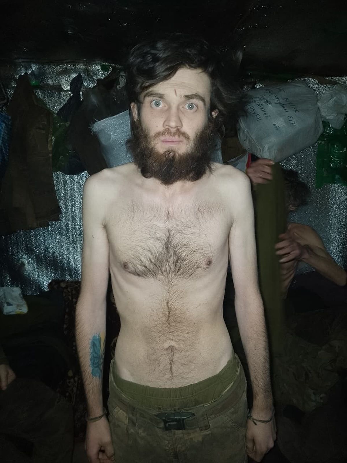 Soldados de la Brigada Mecanizada 14 muestran signos evidentes de una desnutrición severa tras pasar semanas aislados en sus posiciones de combate por el bloqueo de suministros. El Ministerio de Defensa admitió que la falta de raciones obligó a estos hombres a consumir agua de lluvia para sobrevivir mientras las rutas de acceso permanecían bajo el fuego constante de la artillería rusa. Soldados de la Brigada Mecanizada 14 muestran signos evidentes de una desnutrición severa tras pasar semanas aislados en sus posiciones de combate por el bloqueo de suministros. El Ministerio de Defensa admitió que la falta de raciones obligó a estos hombres a consumir agua de lluvia para sobrevivir mientras las rutas de acceso permanecían bajo el fuego constante de la artillería rusa.