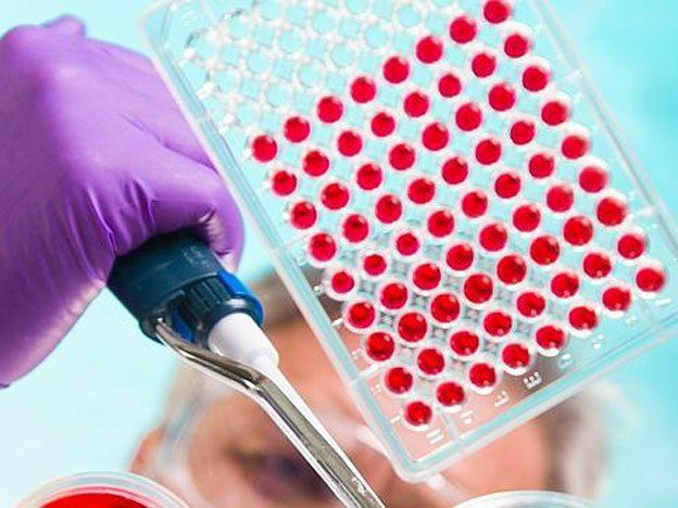 Un test sanguíneo para anticipar el mal de alzhéimer