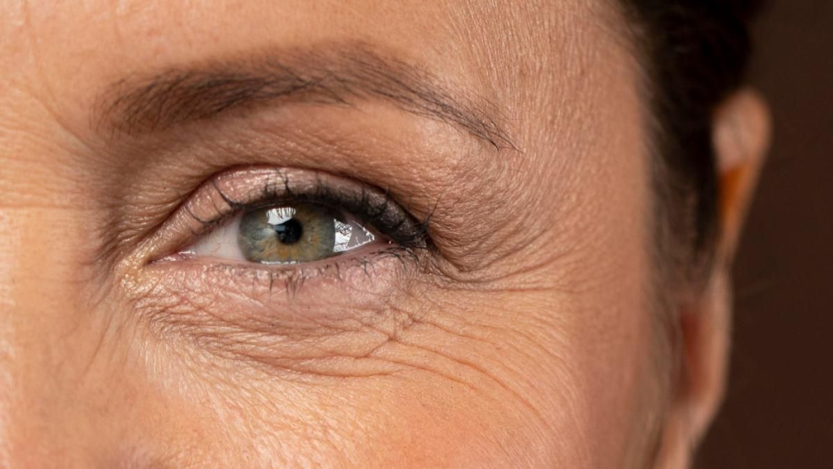 Eliminar las arrugas del contorno de ojos, es posible con este sencillo truco casero.