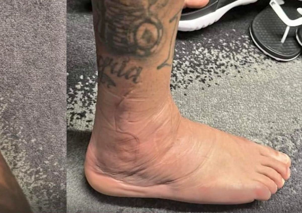 El tobillo de Neymar a unas horas de la lesión en el Mundial Qatar 2022
