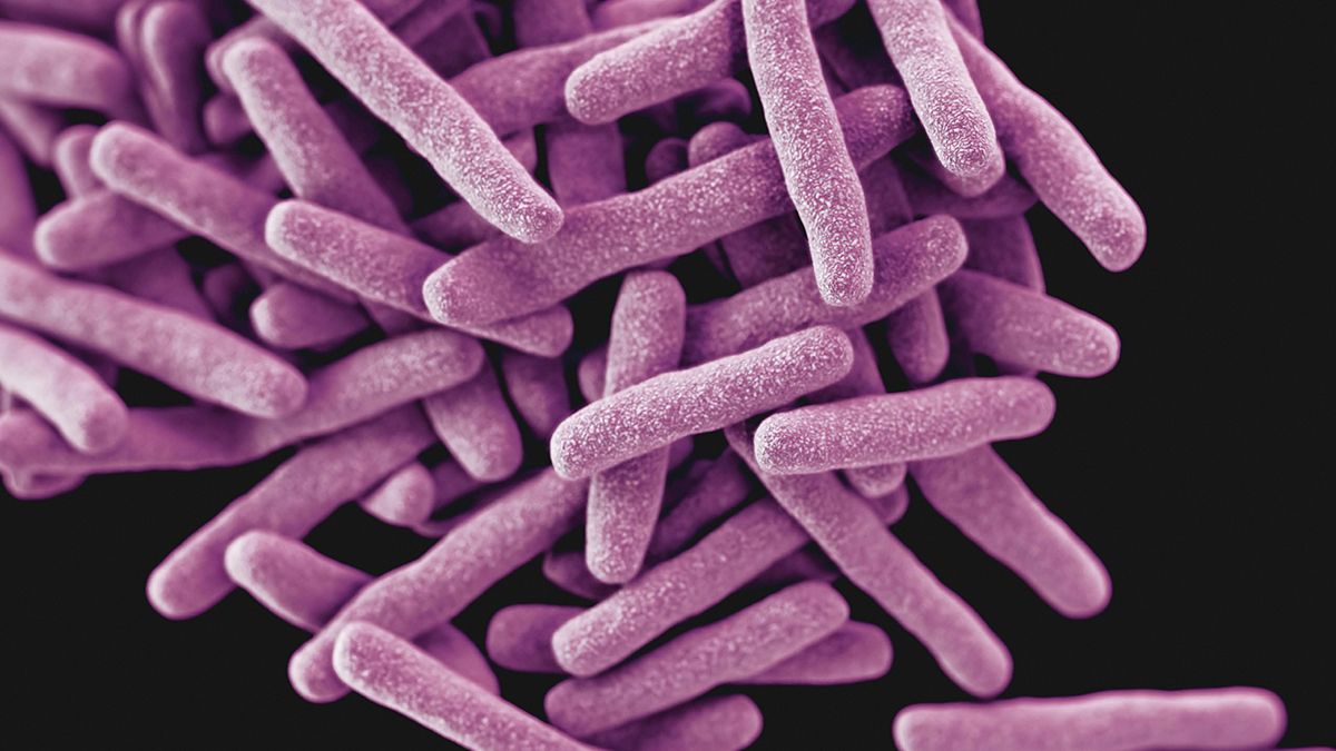 Se registró un brote de tuberculosis en Kansas City en Estados Unidos, el mayor registrado desde 1950.