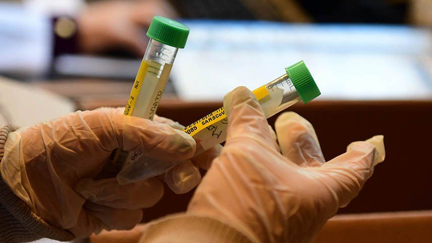 Los laboratorios de análisis clínicos de Mendoza comenzarán a implementar el pago de un coseguro desde el lunes. El valor es de $3.000.