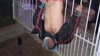 Quiso entrar a robar y quedó colgado de la reja