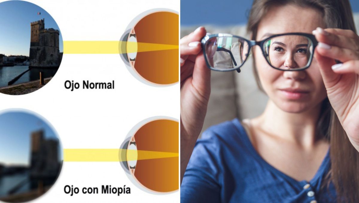 La miopía suele aparecer durante la infancia y la adolescencia. Por lo general, se estabiliza entre los 20 y los 40 años y tabién suele ser hereditaria. La miopía suele aparecer durante la infancia y la adolescencia. Por lo general, se estabiliza entre los 20 y los 40 años y tabién suele ser hereditaria.