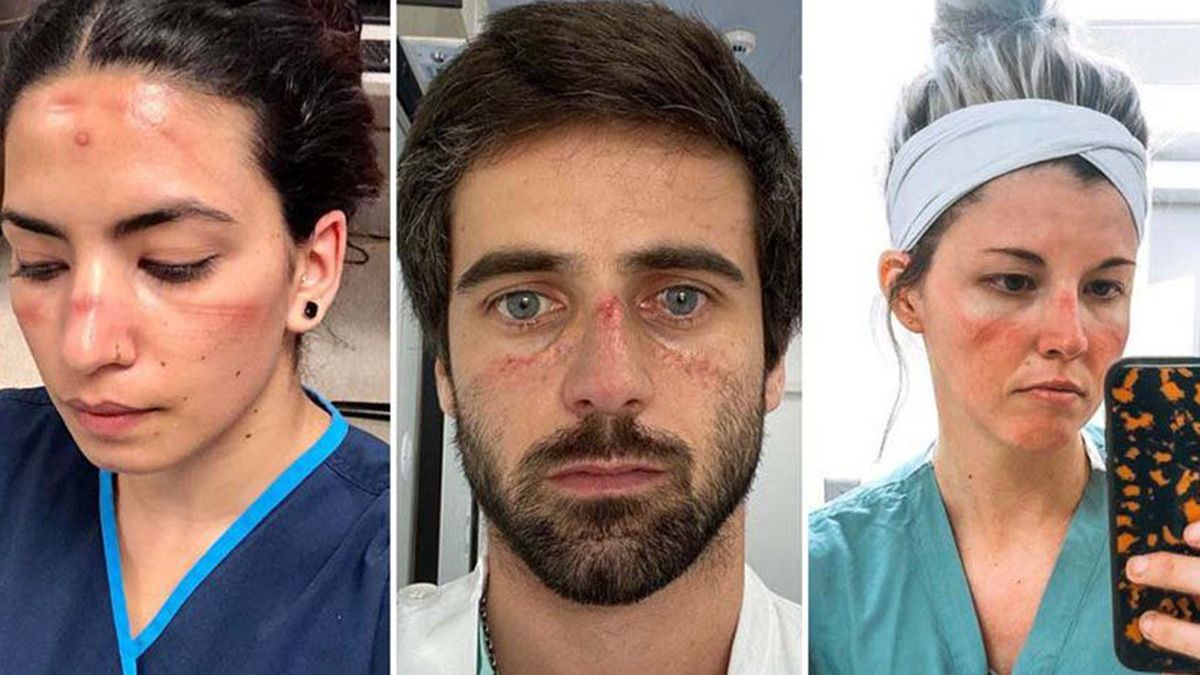 El personal médico muestra el impacto de la pandemia en sus rostros.