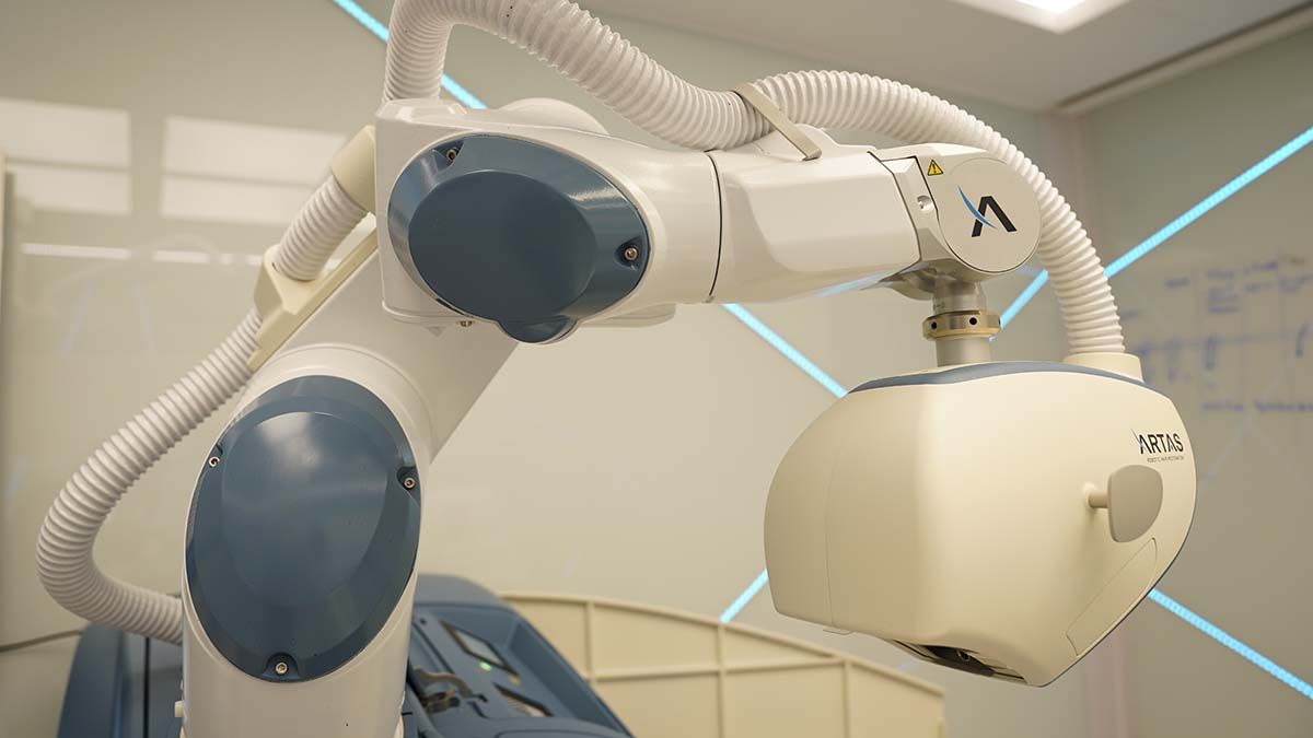 ARTAS cuenta con dos cámaras en su última versión, disponible en Hair Recovery.