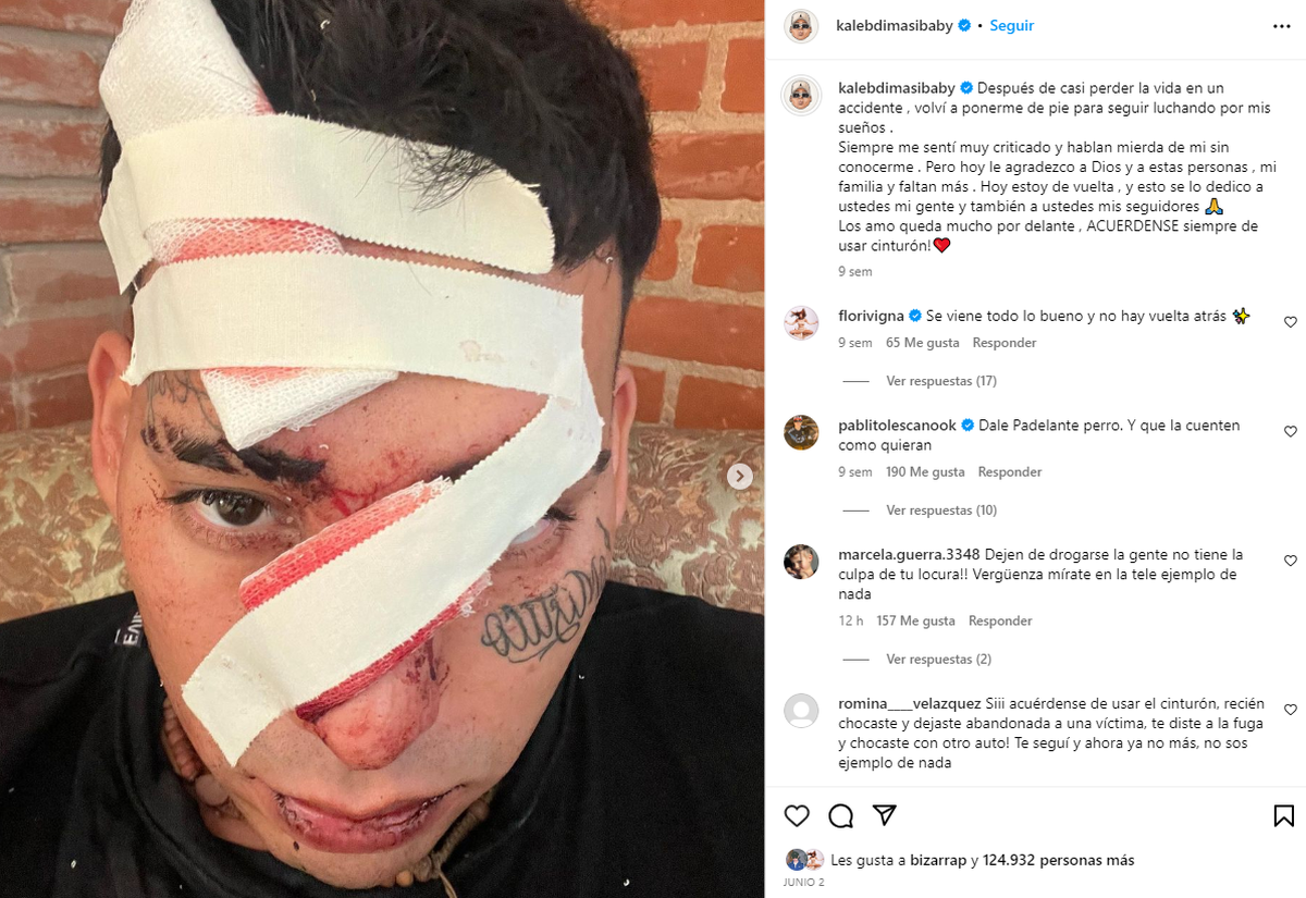 El cantante Kaleb Di Masi había protagonizado un accidente similar con un patrullero en abril de este año a causa del cual le habrían quitado su registro. El cantante Kaleb Di Masi había protagonizado un accidente similar con un patrullero en abril de este año a causa del cual le habrían quitado su registro.