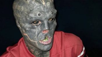 Para parecerse a un alien se cortó cuatro dedos de las manos