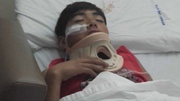 Cobarde: Un hombre atropelló a un niño de 12 años y se dio a la fuga