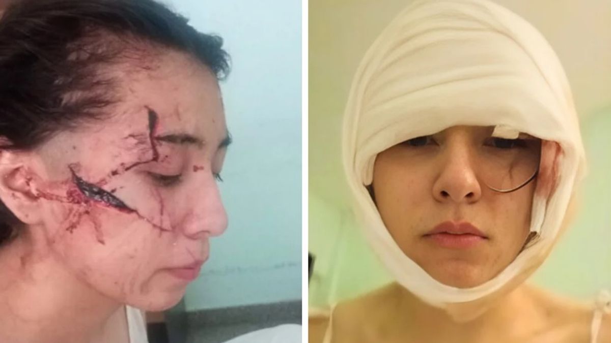 Un grupo de jóvenes atacó brutalmente a golpes y con cuchillos a una adolescente de 15 años provocándole graves heridas en el rostro.