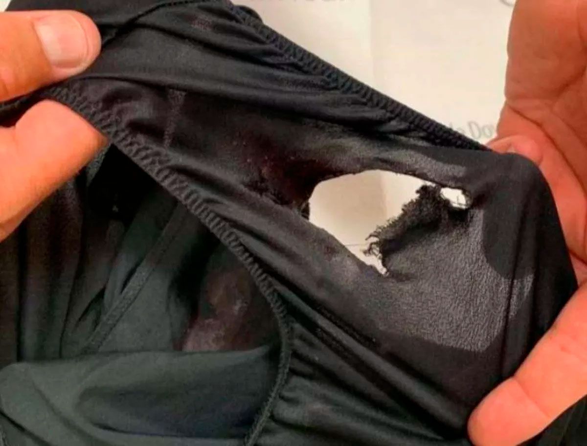 Ladrón quiso saltar una reja, se la clavó en los testículos y pidió ayuda a los gritos