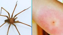 La picadura de la araña violinista puede ser hasta letal.