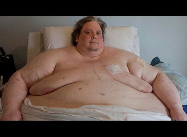 Murió el hombre más gordo del mundo