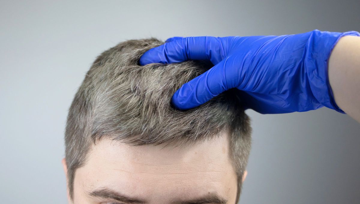 Qué quiere decir si me aparecen canas siendo joven y cuál es el significado