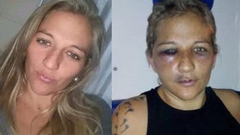 Sufrió una salvaje paliza de parte de su expareja y otras dos mujeres