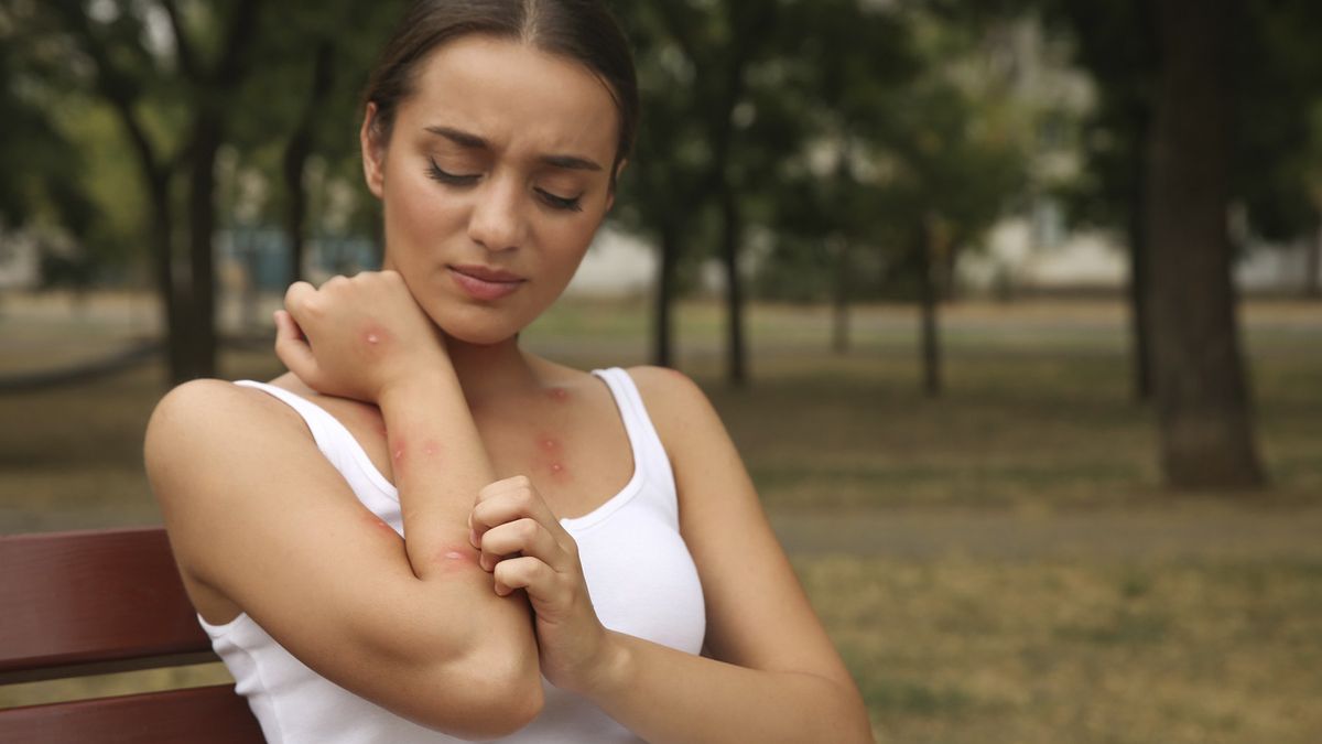 Dile adiós a las picaduras de mosquitos con un simple truco casero.