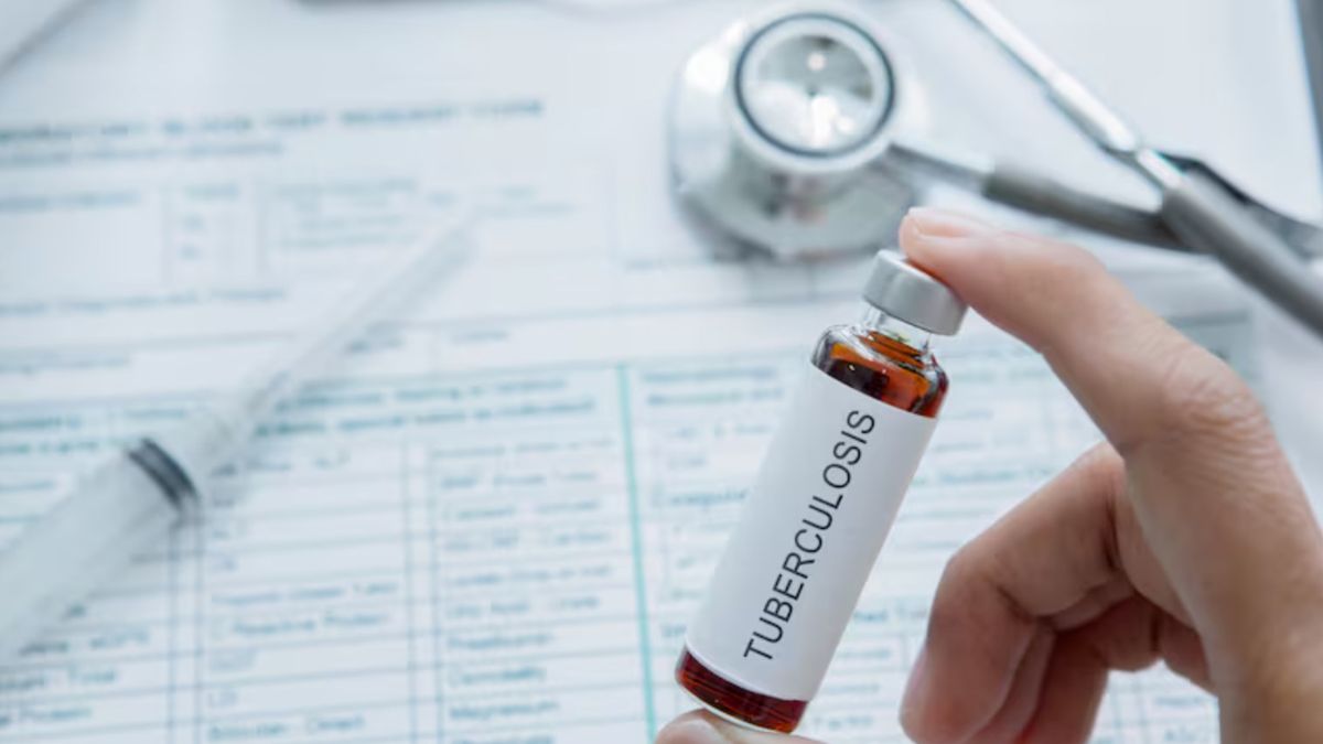 La tuberculosis se transmite a través del aire cuando una persona infectada habla, escupe, tose o estornuda La tuberculosis se transmite a través del aire cuando una persona infectada habla, escupe, tose o estornuda