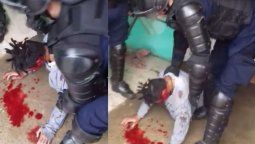 Perdió el ojo tras recibir el impacto de una bala de goma de la policía