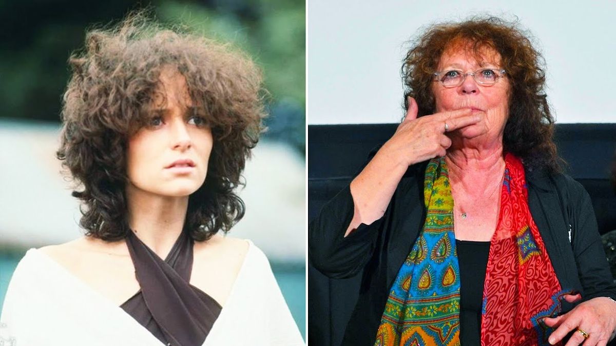 Antes y después de la actriz Joanne Samuel. Antes y después de la actriz Joanne Samuel. 