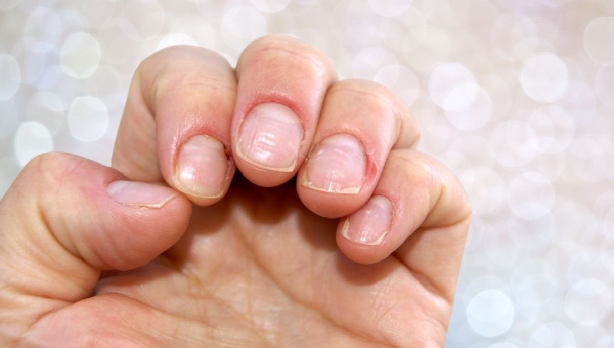 Líneas de Beau: por qué aparecen en las uñas