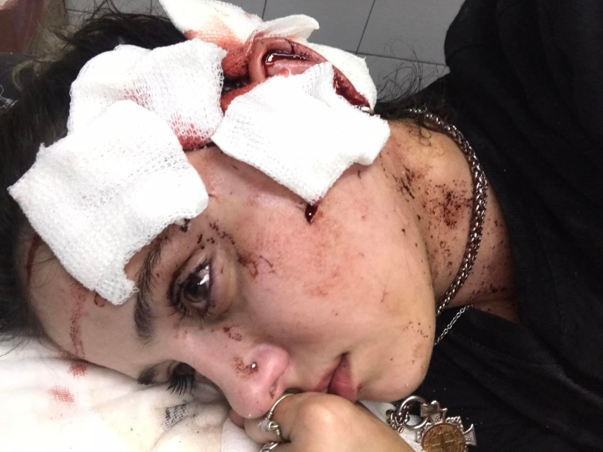 La moza de la calle Arístides fue atendida en el Hospital Central.