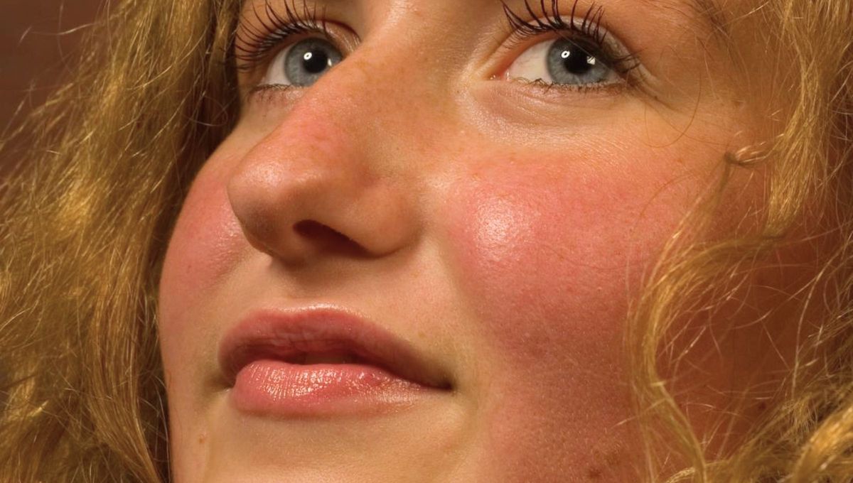 ¿Sabías que los humanos son los únicos animales que se ponen rojos?