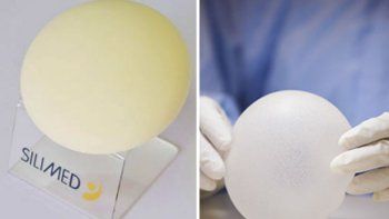 Varios países suspendieron la venta de implantes mamarios brasileños