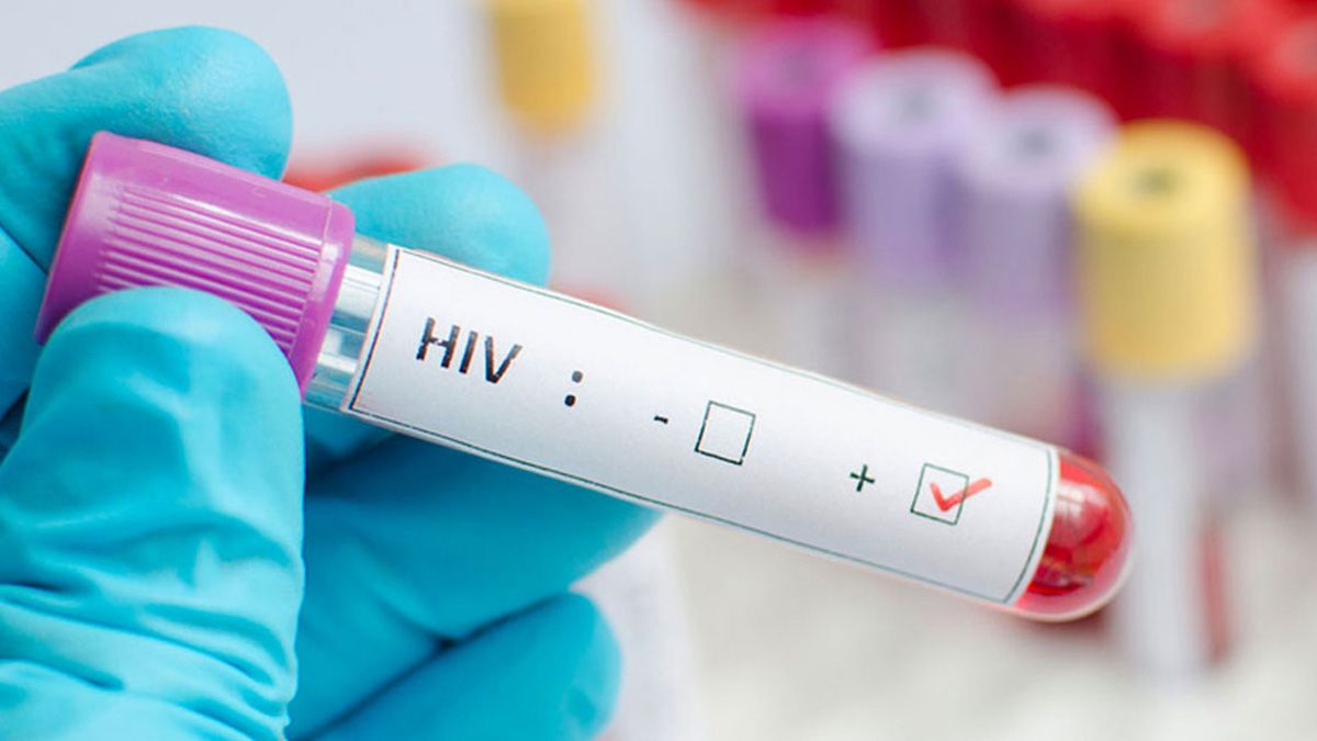 Unas 5.000 personas adquieren el virus del Sida cada año, una situación que tratan de combatir los especialistas Unas 5.000 personas adquieren el virus del Sida cada año, una situación que tratan de combatir los especialistas