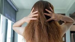 Dile adiós al frizz con esta mascarilla casera. Imagen: Freepik.