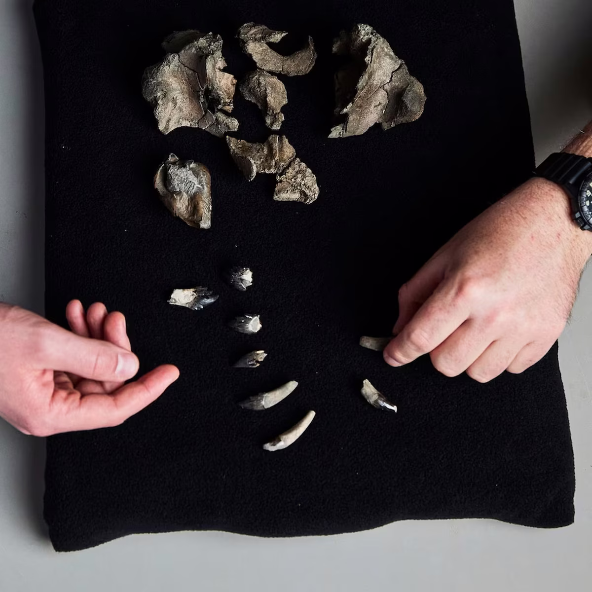 Los dientes de esta ballena sorprendieron a los científicos en el análisis Los dientes de esta ballena sorprendieron a los científicos en el análisis