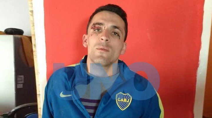 Cayó Andrés Tello, acusado de balear a un menor y amenazar a policías con una granada