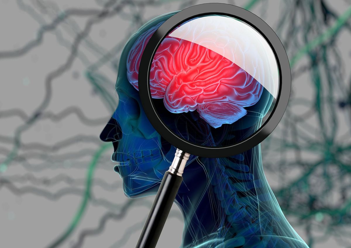 Tratamientos científicos que buscan tratar la depresión&nbsp;