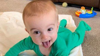 Michael, el bebé que despertó tras de siete meses en coma y le sonrió a su padre