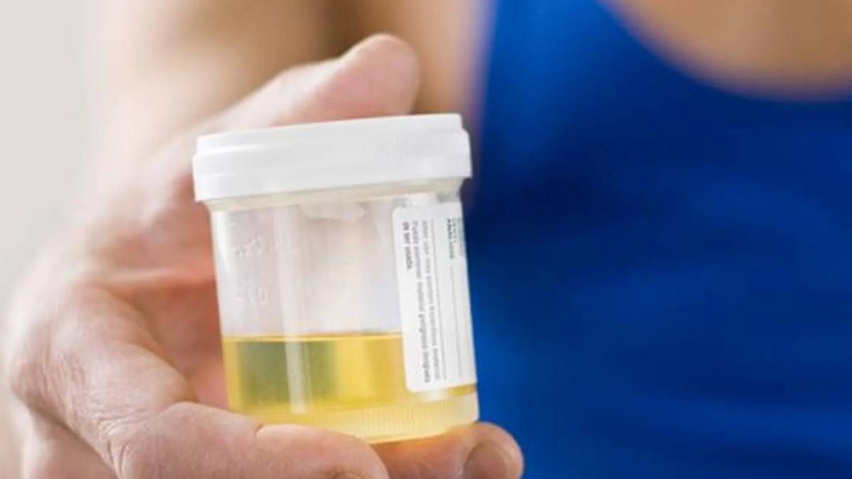 Qué significa beber orina para la salud.