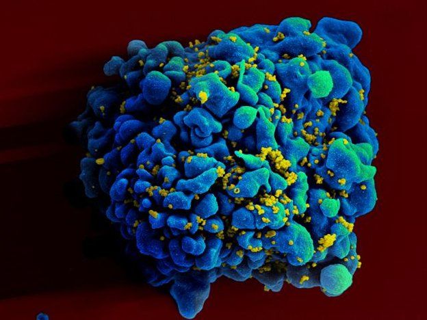 Descubrieron la molécula responsable de la propagación del virus del VIH