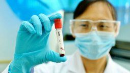 Estados Unidos aprueba un nuevo test de Roche para diagnosticar el coronavirus
