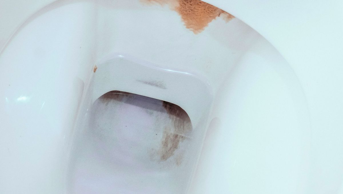 El inodoro es uno de los objetos de la casa con mayor número de virus, bacterias y gérmenes. El inodoro es uno de los objetos de la casa con mayor número de virus, bacterias y gérmenes. 