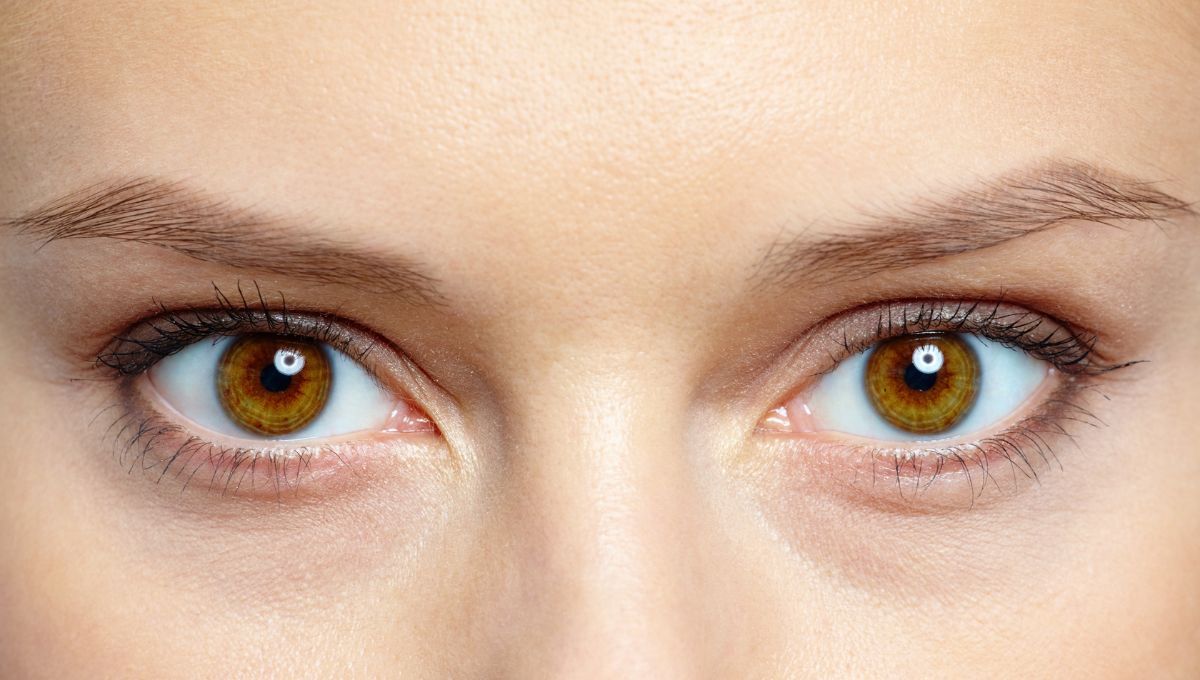 Las ojeras no son todas iguales y se deben tratar de manera puntual.&nbsp;