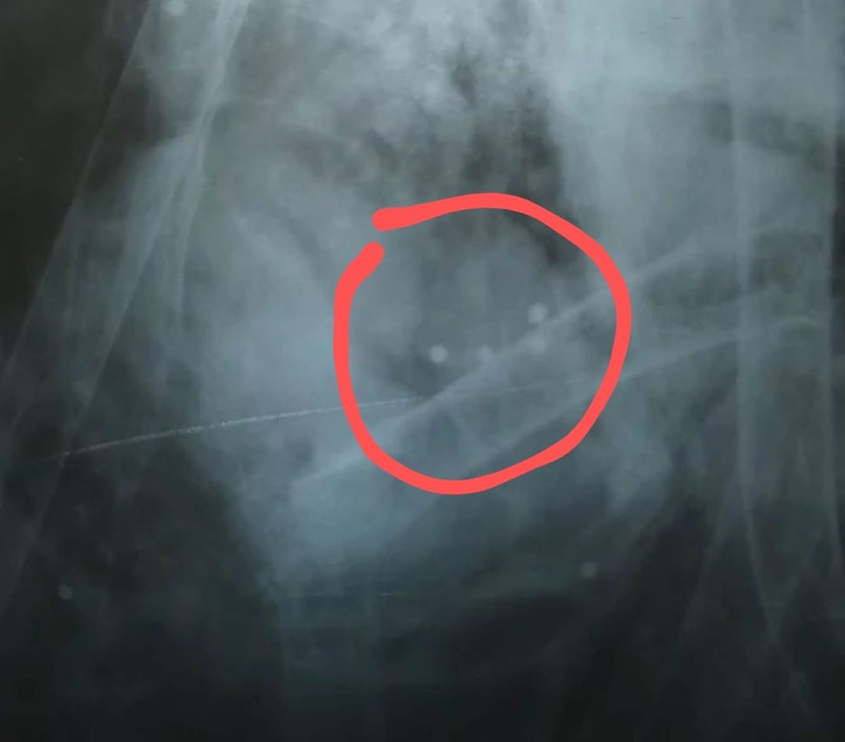 Radiografía del cóndor andino donde se muestran los perdigones Radiografía del cóndor andino donde se muestran los perdigones