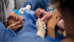 Ocho de cada 10 bebés nacen por cesárea en hospitales y clínicas privadas de Mendoza. Buscan revalorizar el parto vaginal, fisiológico y seguro.
