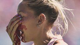 El impactante bochazo en el rostro que recibió Micaela Retegui