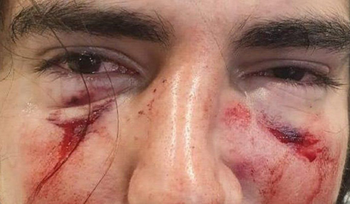 Lautaro Insúa fue brutalmente golpeado en el rostro a trompadas y patadas