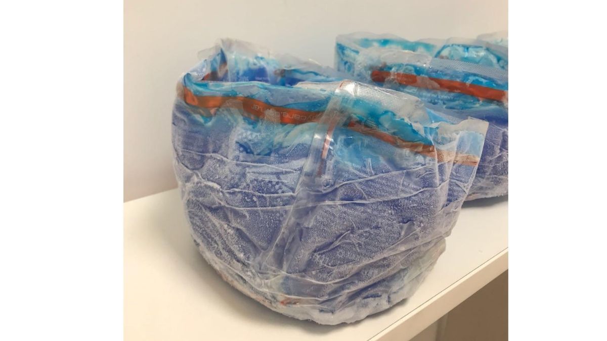 Cascos fríos, un tratamiento innovador para no perder el pelo durante la quimioterapia 