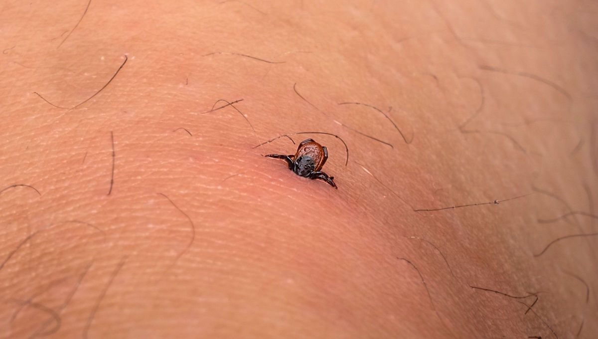 Las garrapatas pueden estar presentes y ser transmitidas en casi cualquier rincón, desde una suela de zapatos, hasta el collar de nuestra mascota pueden introducirlas en nuestra vida sin esperarlo. Las garrapatas pueden estar presentes y ser transmitidas en casi cualquier rincón, desde una suela de zapatos, hasta el collar de nuestra mascota pueden introducirlas en nuestra vida sin esperarlo.