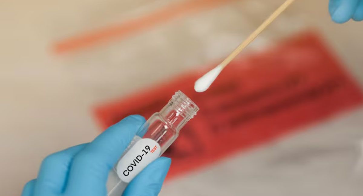 La variante XFG del Covid-19, conocida como La variante XFG del Covid-19, conocida como